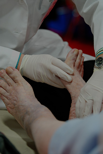 Feet Problems in Diabetes