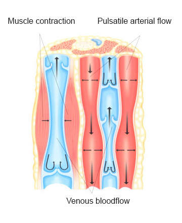 Varices